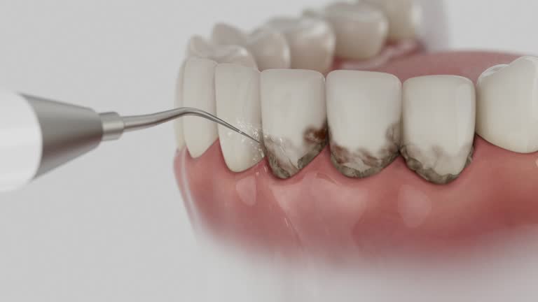Trusted Teeth Cleaning And Checkup service in Kankakee, IL - Dentist Open Now
